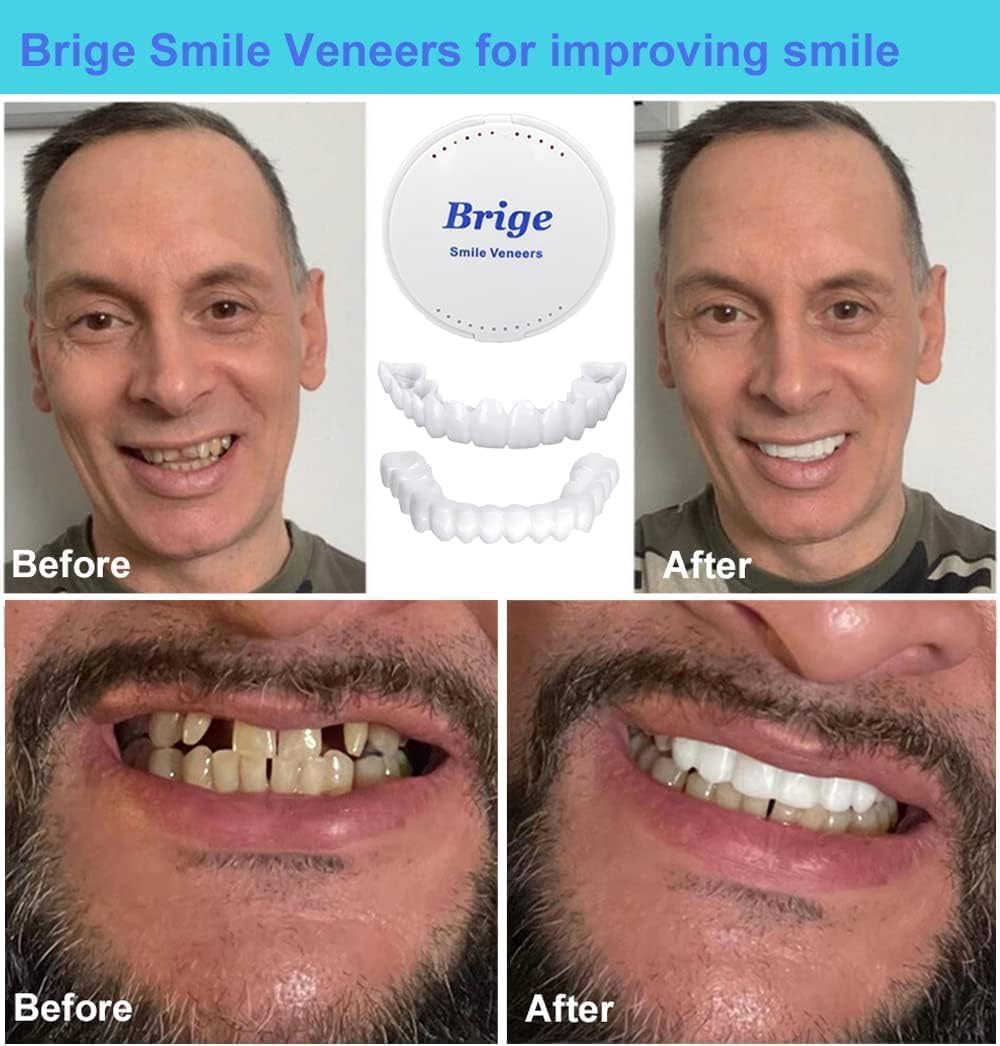 Zorill Snap-On Instant Perfect Smile Veneers Comfortable Flex Fit Dentures for Top & Bottom Teeth White Tooth Cosmetic Cover PACK OF 1 (5) (5) (5) (1)