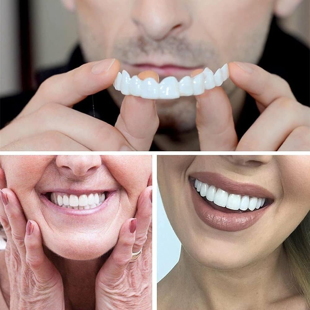 Zorill Snap-On Instant Perfect Smile Veneers Comfortable Flex Fit Dentures for Top & Bottom Teeth White Tooth Cosmetic Cover PACK OF 1 (5) (5) (5) (1)