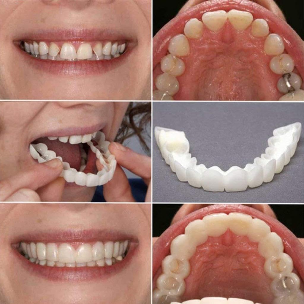 Zorill Snap-On Instant Perfect Smile Veneers Comfortable Flex Fit Dentures for Top & Bottom Teeth White Tooth Cosmetic Cover PACK OF 1 (5) (5) (5) (1)
